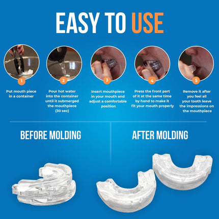 Clear Anti-Snore Mouthpiece – Adjustable Night Guard for Teeth Grinding & Clenching | Self-Moldable Dental Protector with Precision Fit.