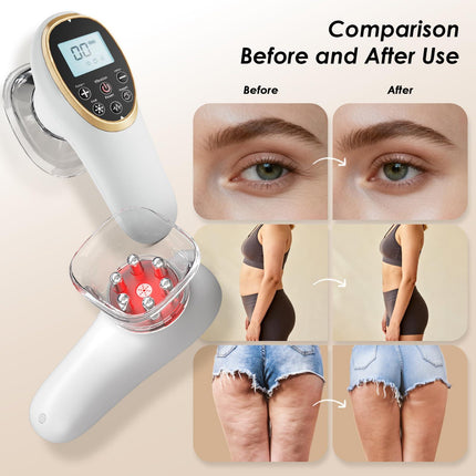 Modern Jingluo Beauty Massager – Electric Meridian Facial & Body Roller with Gentle Suction and Warmth, Multi-Speed Skincare Tool for Relaxing Rituals (White).