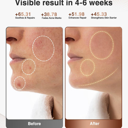 High-Performance 3D LED Beauty Mask – 4 Light Modes, 328 LEDs, Wireless Operation, Adjustable Timer, Lightweight & Flexible Fit – Reveal Radiant Skin (Brown).