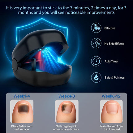 Nail Wellness Light Device (1-Piece): Red & Blue LED for Daily Nail Care Routine – Auto Timer, USB Rechargeable (Black).