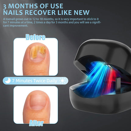Nail Wellness Light Device (1-Piece): Red & Blue LED for Daily Nail Care Routine – Auto Timer, USB Rechargeable (Black).