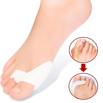 Silicone Toe Corrector | Toe Spreader | Hallux Valgus | Big and Little Toe Protector | 1 Pair.