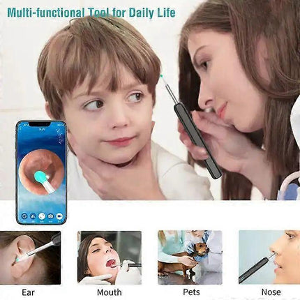 Wireless Smart Visual Ear Cleaner Usb WiFi Otoscope TW1 Ear Wax Removal Tool Set with Camera Ear Endoscope HD 1080P for iPhone iPad Android [db].