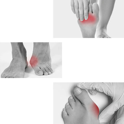 Onemayship Silicone Gel Toe Separator Orthotics Bunion Toes Spacer Pain Reliever 12Pcs.
