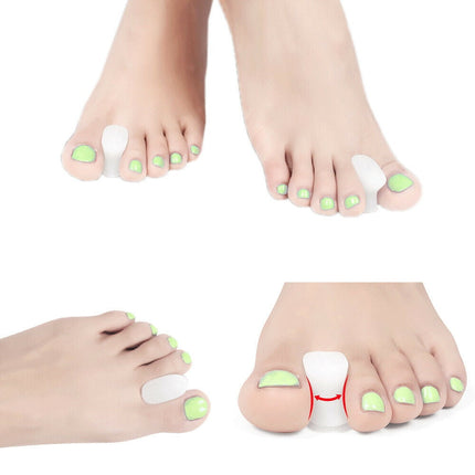 Onemayship Silicone Gel Toe Separator Orthotics Bunion Toes Spacer Pain Reliever 12Pcs.