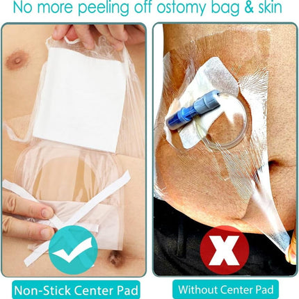 25 Pcs Waterproof Ostomy Shower Cover 8"x8" Stoma Bath Protector Shield Dressing Bandage for Colostomy Supply Pouch Guard Accessory 8x8 Inch (Pack of 25).