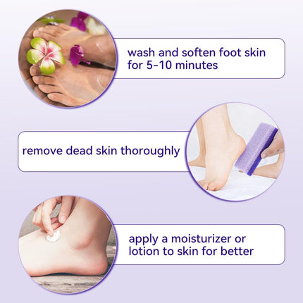 4 Pcs Foot Pumice Stone and Scrubber for Feet and Heels Callus and Dead Skins (Purple).