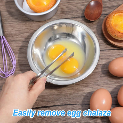 2PCS Egg Chalaza Removal Tool,Stainless Steel Tongs,Toothed Design Eggshell Fragment Membrane Remover Tong,Multipurpose Kitchen Tool for Cooking Food Cake Bakers Pastry Chefs.