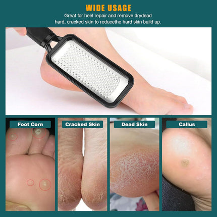 Foot Rasp Foot File, 2 Pcs Stainless Steel Pedicure Callus Remover for Feet, Professial Foot Care Tools for Pedicure to Removes Hard Skin Corns for Dry and Wet Feet.