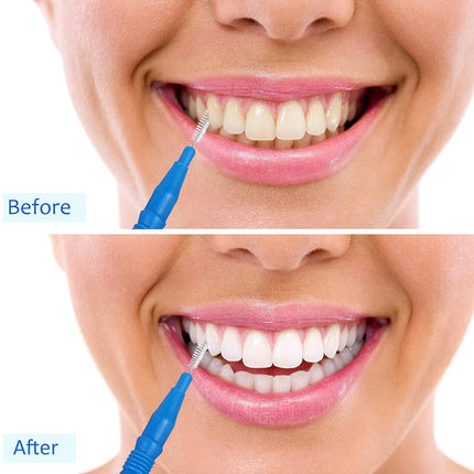 100 Pcs Braces Dental Brush Flosser for Cleaner Interdental Brush Toothpick Tooth Flossing Head Oral Dental Toothpick Cleaners Cleaning Tool(Red and Blue).