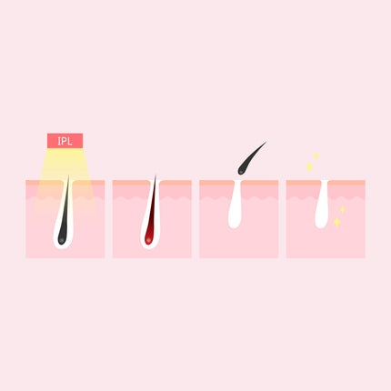 Silhouette Portable Laser Hair Remover Permanent Epliation System Body Face Home.