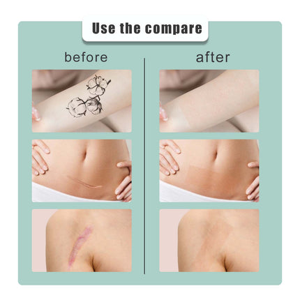 South moon Birthmark Skin Tone Concealer, Cover Body Scars Tattoo Spots Waterproof Color Masking Tape.