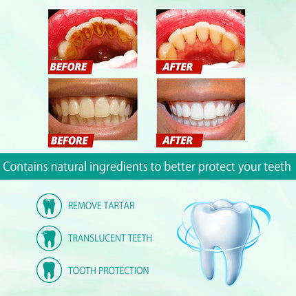 Foam Toothpaste Breath Freshening Whitening Toothpaste Tooth Anti-Moth Mouth Cleaning Tooth Stains And Gum Care.