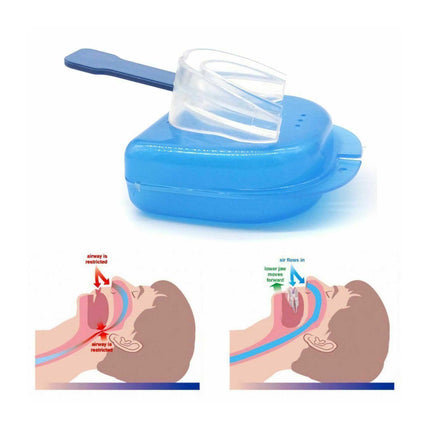 3x Mouthguard Mouthpiece + 3x Nose Clip Anti Snoring Aid Sleep Breathing Device.