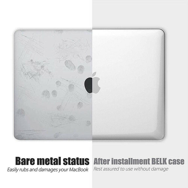 2020 Macbook Pro 13 Inch Case Plastic Hard Case Shell for 2020 Macbook Pro A2251 A2289 A2179(Clear).