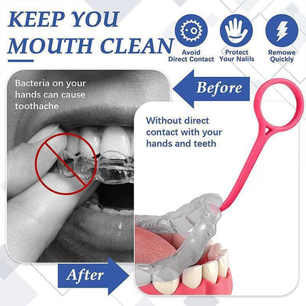5PCS Aligner Remover Tool Hook Kit for Invisible Braces and Retainer Handling.