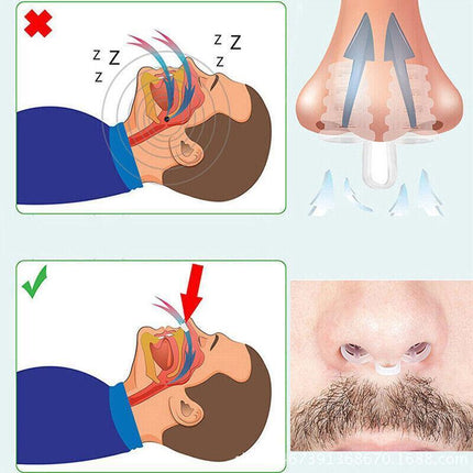 PE Nasal Vent Clip for Comfortable Breathing Airflow Support Accessory.