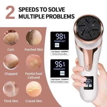 Black Electric Foot Callus Remover - Rechargeable Waterproof Pedicure Tool with Automatic Dead Skin Removal.