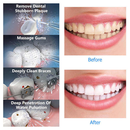 Black Advanced Portable Water Flosser - Rechargeable Oral Irrigator, IPX7 Waterproof, 4 Cleaning Modes for Deep Dental Care.