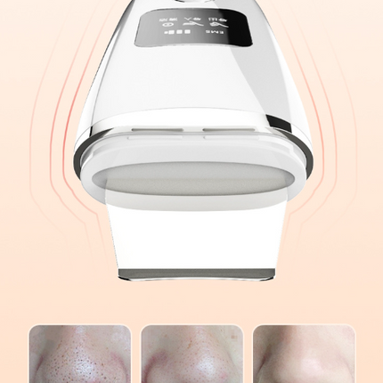 White Professional 4-in-1 Ultrasonic Skin Scrubber - Deep Pore Cleanser, Blackhead Remover & EMS Facial Lifting Tool.