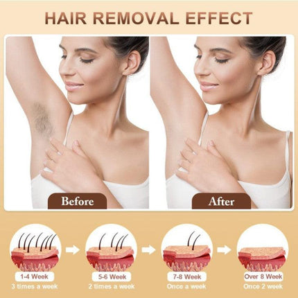 IPL Hair Removal Device - 3-in-1 Permanent Hair Reduction, Skin Rejuvenation & Acne Control(white).