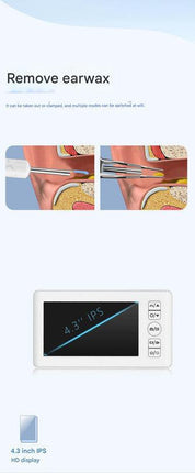 All-in-One Wireless Visual Ear Cleaner Kit with 4.3" IPS Display Screen(white).