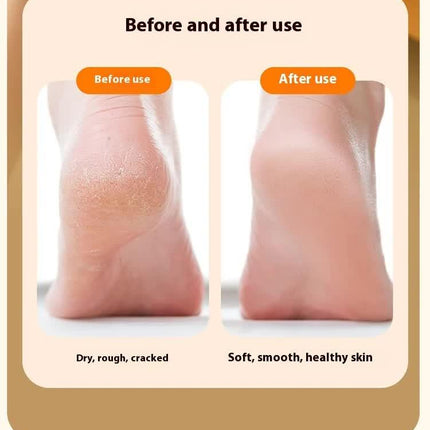 Electric Foot Callus Remover Rechargeable Pedicure Tool with 3 Grinding Heads Portable Dead Skin Exfoliator Peach Pink.