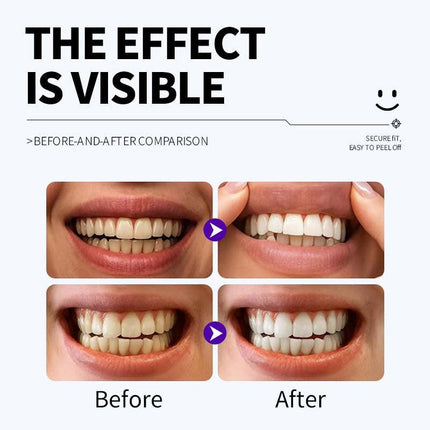 Professional Enamel-Safe Teeth Whitening Strips(12 Strips per Pack) - Antibacterial Gum Care & Deep Cleaning.