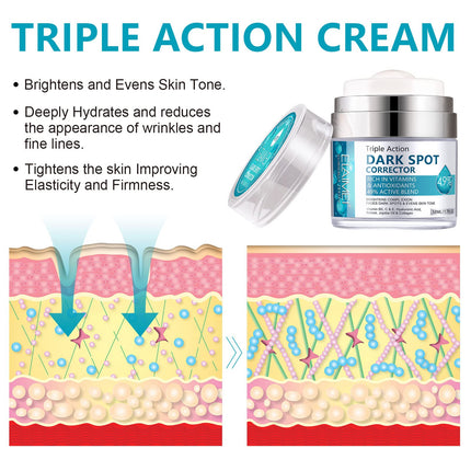 Age Spot Cream | Fades Freckles & Skin Pigmentation | Dark Spot Corrector for Even Skin Tone.
